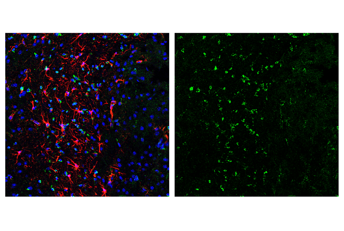 Immunofluorescence Image 3: Smac/Diablo (D5S3R) Rabbit Monoclonal Antibody