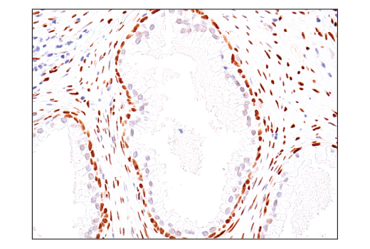 Immunohistochemistry Image 6: TEAD1 (D9X2L) Rabbit Monoclonal Antibody (BSA and Azide Free)