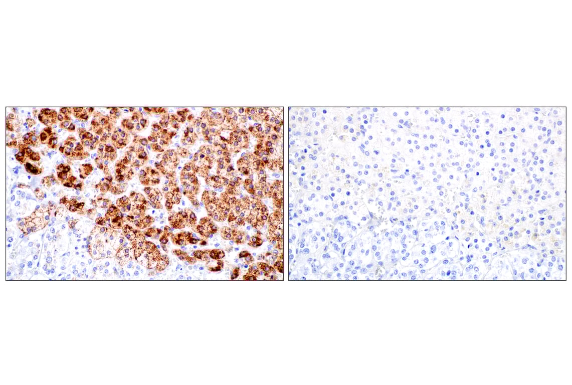 Immunohistochemistry Image 11: NPC1 (E7S4N) Rabbit Monoclonal Antibody