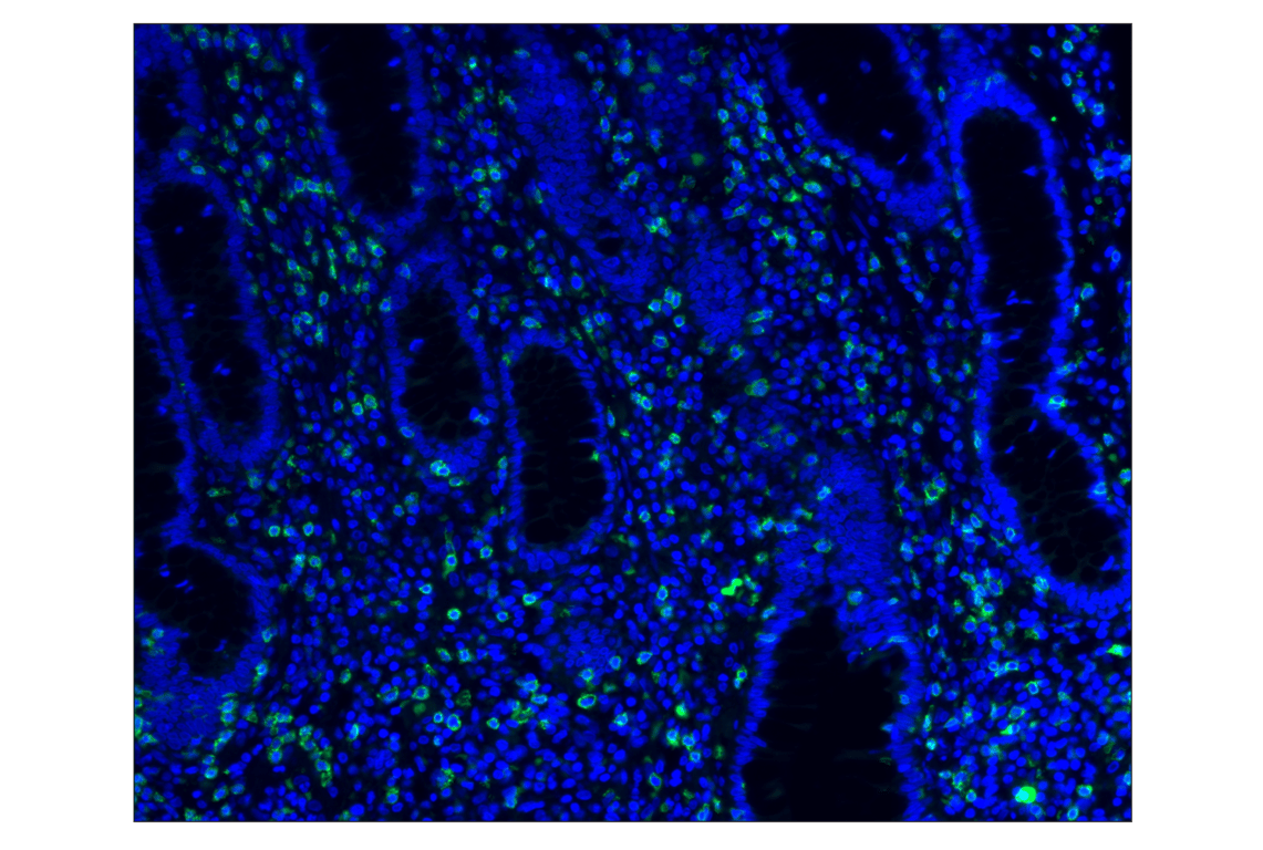 Immunohistochemistry Image 1: CD8α (D8A8Y) Rabbit mAb (Alexa Fluor<sup>®</sup> 488 Conjugate)