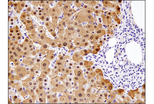 Immunohistochemistry Image 2: Arginase-1 (D4E3M<sup>™</sup>) Rabbit Monoclonal Antibody