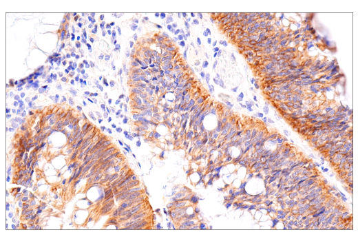 Immunohistochemistry Image 1: HER2/ErbB2 (CB11) Mouse Monoclonal Antibody