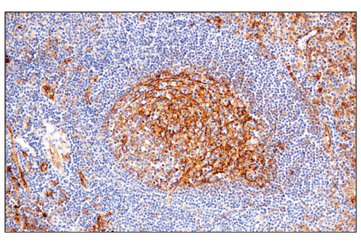 Immunohistochemistry Image 5: CD54/ICAM-1 (E3Q9N) XP<sup>®</sup> Rabbit mAb