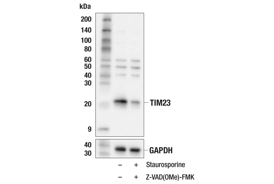 Western Blotting Image 2: TIM23 (E1Q7L) Rabbit Monoclonal Antibody
