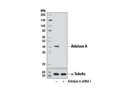 undefined Image 1: SignalSilence<sup>®</sup> Aldolase A siRNA I