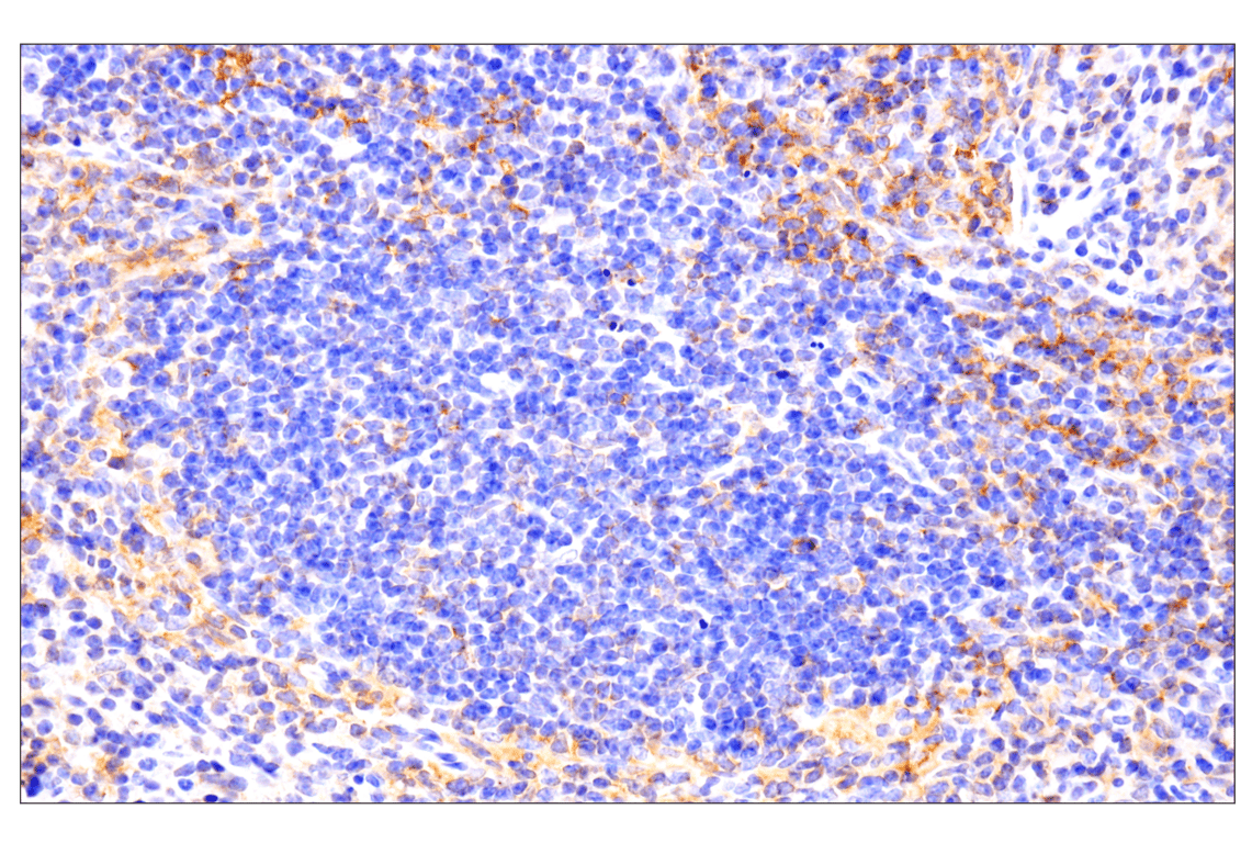 Immunohistochemistry Image 3: PD-L1 (F3Z1T) Rabbit Monoclonal Antibody (BSA and Azide Free)