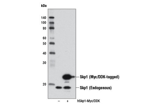 Western Blotting Image 2: Skp1 (D3J4N) Rabbit Monoclonal Antibody