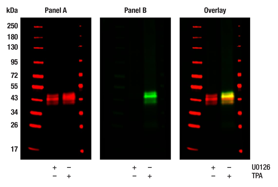 Western Blotting Image 1: p44/42 MAPK (Erk1/2) (L34F12) Mouse Monoclonal Antibody