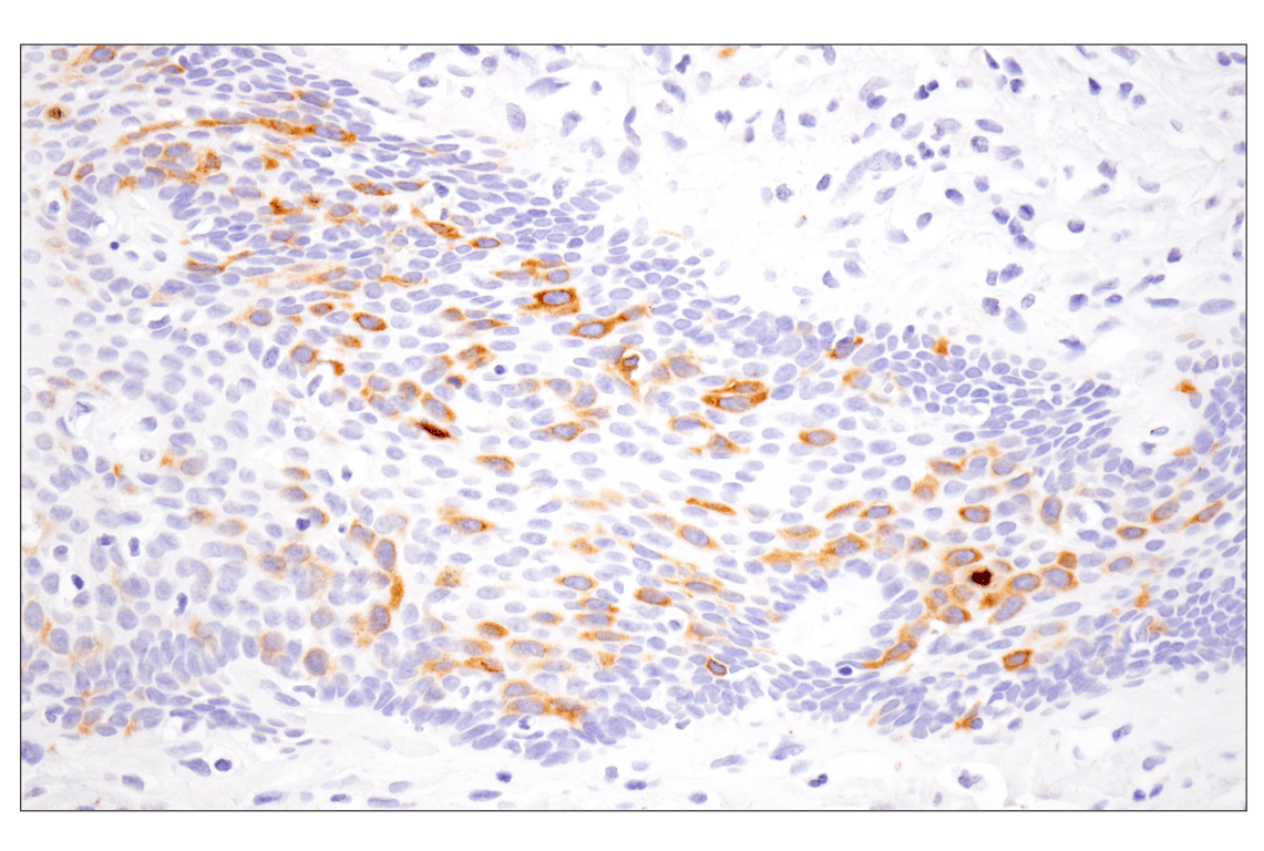 Immunohistochemistry Image 8: Eg5 (E1L3W) Rabbit Monoclonal Antibody
