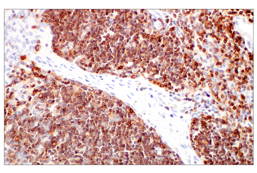 Immunohistochemistry Image 5: CD7 (E4G1Q) Rabbit Monoclonal Antibody (BSA and Azide Free)