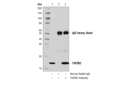 Immunoprecipitation Image 1: THEM2 Antibody