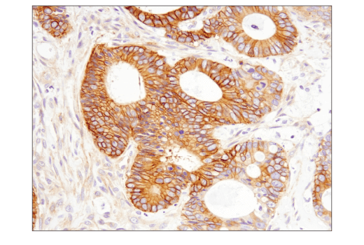 Immunohistochemistry Image 2: RhoB (D1J9V) Rabbit Monoclonal Antibody