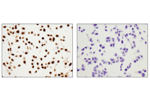 Immunohistochemistry Image 2: p63 (D9L7L) Rabbit Monoclonal Antibody