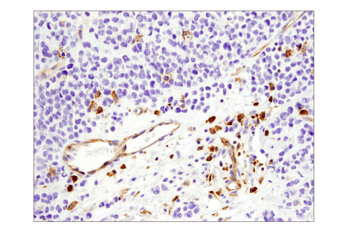 Immunohistochemistry Image 3: VISTA (D1L2G) Rabbit Monoclonal Antibody