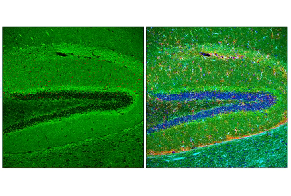 Immunofluorescence Image 2: GAP43 (E1U1D) Mouse Monoclonal Antibody