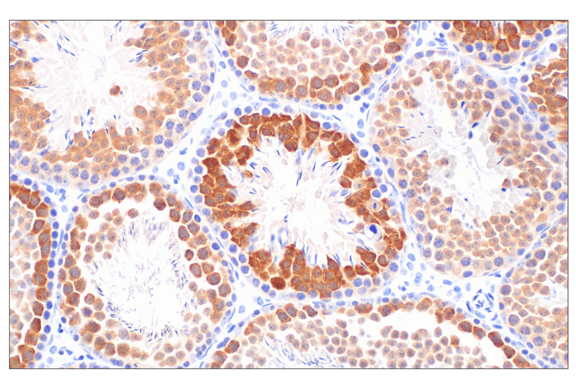 Immunohistochemistry Image 9: PBK/TOPK (F2X2Z) Rabbit Monoclonal Antibody