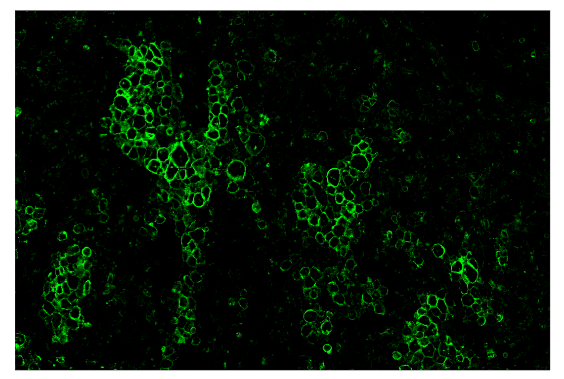 Immunohistochemistry Image 2: CD86 (E2G8P) & CO-0038-488 SignalStar<sup>™</sup> Oligo-Antibody Pair