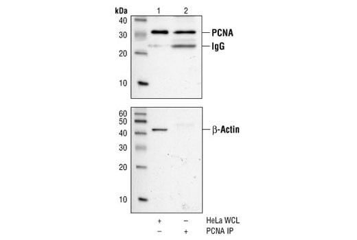 Immunoprecipitation Image 1: PCNA (PC10) Mouse Monoclonal Antibody
