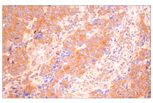 Immunohistochemistry Image 5: B-Raf (E3T5C) Mouse Monoclonal Antibody