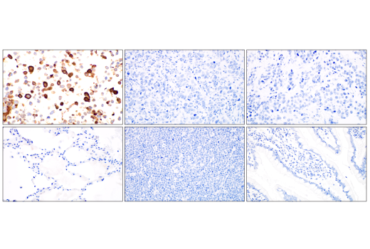 Immunohistochemistry Image 3: SARS-CoV-2 Nucleocapsid Protein (E9L7H) Rabbit Monoclonal Antibody
