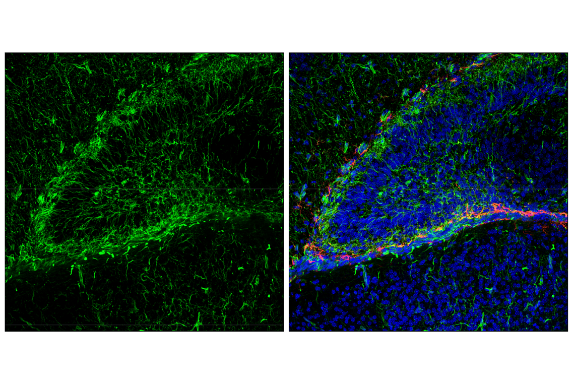Nestin (E5C7I) Rabbit Monoclonal Antibody (Alexa Fluor® 488