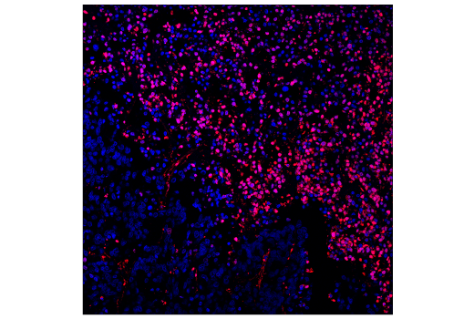 Immunohistochemistry Image 2: TUNEL Assay Kit (Fluorescence, 594 nm)