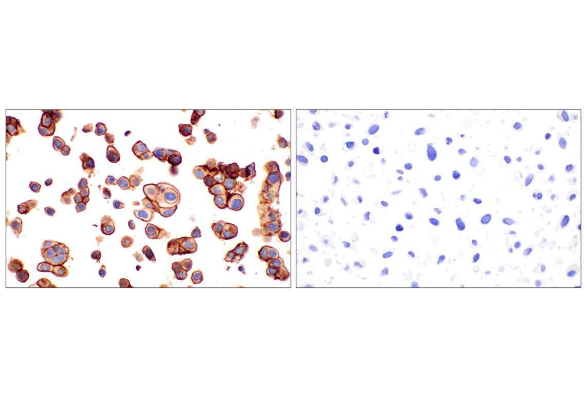 Immunohistochemistry Image 12: TACSTD2/TROP2 (F4W4J) Rabbit Monoclonal Antibody