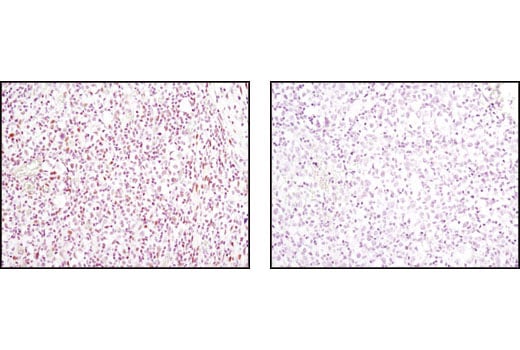 Immunohistochemistry Image 1: AML1 (D33G6) Rabbit Monoclonal Antibody
