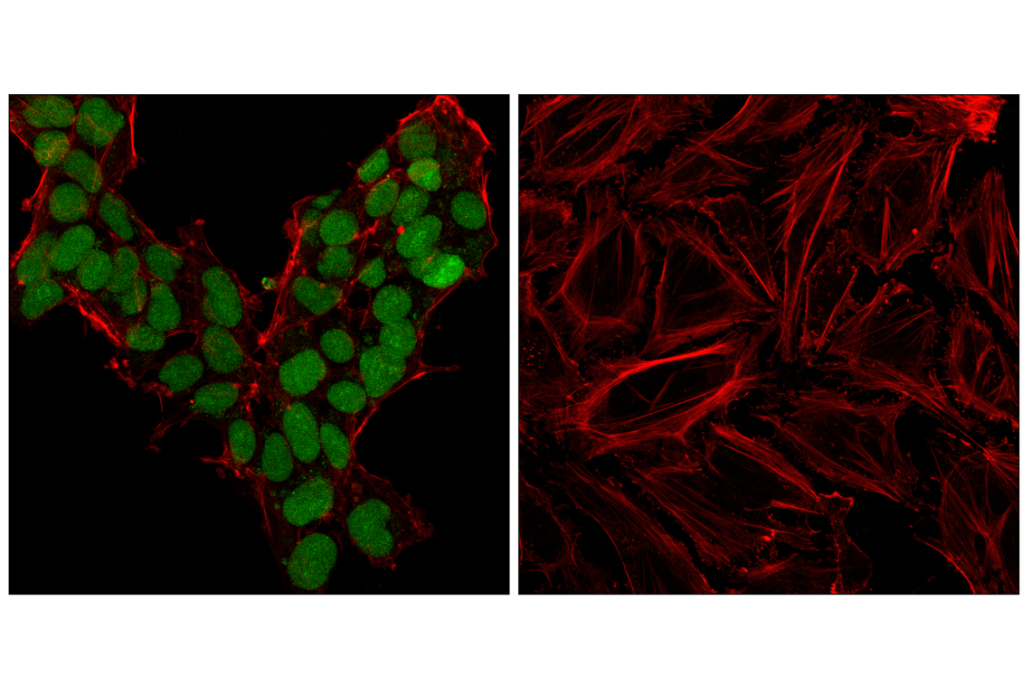 Immunofluorescence Image 1: Sox2 (D9B8N) Rabbit Monoclonal Antibody (Alexa Fluor<sup>®</sup> 488 Conjugate)