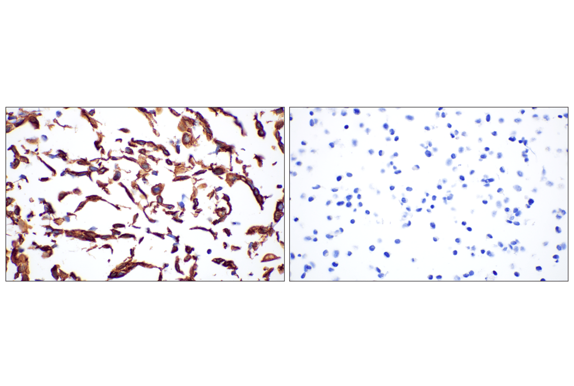 Immunohistochemistry Image 10: Keratin 14 (E7W6V) Rabbit Monoclonal Antibody