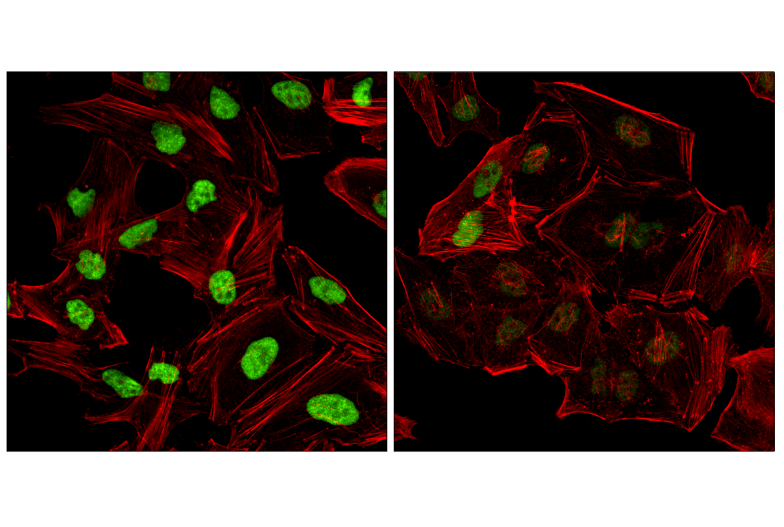 Immunofluorescence Image 1: DDX42 (F4V2L) Rabbit Monoclonal Antibody