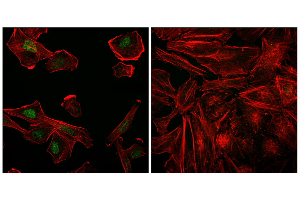 Immunofluorescence Image 1: Myogenin (LO26) Mouse Monoclonal Antibody