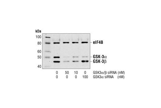 undefined Image 2: SignalSilence<sup>®</sup> GSK-3 alpha/beta siRNA