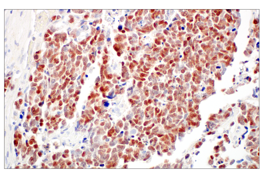 Immunohistochemistry Image 3: ASCL1 (E5S4Q) XP<sup>®</sup> Rabbit mAb