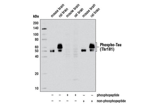 Western Blotting Image 2: Phospho-Tau (Thr181) (D9F4G) Rabbit Monoclonal Antibody (Biotinylated)