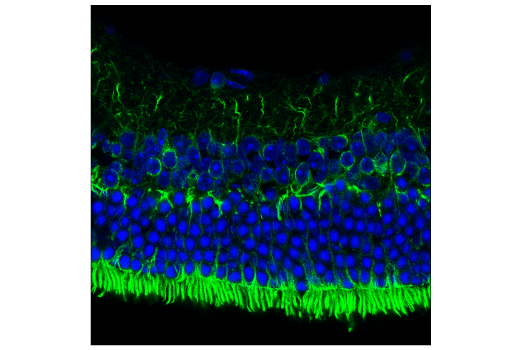 Immunofluorescence Image 4: MAP7 (E8K7O) Rabbit Monoclonal Antibody