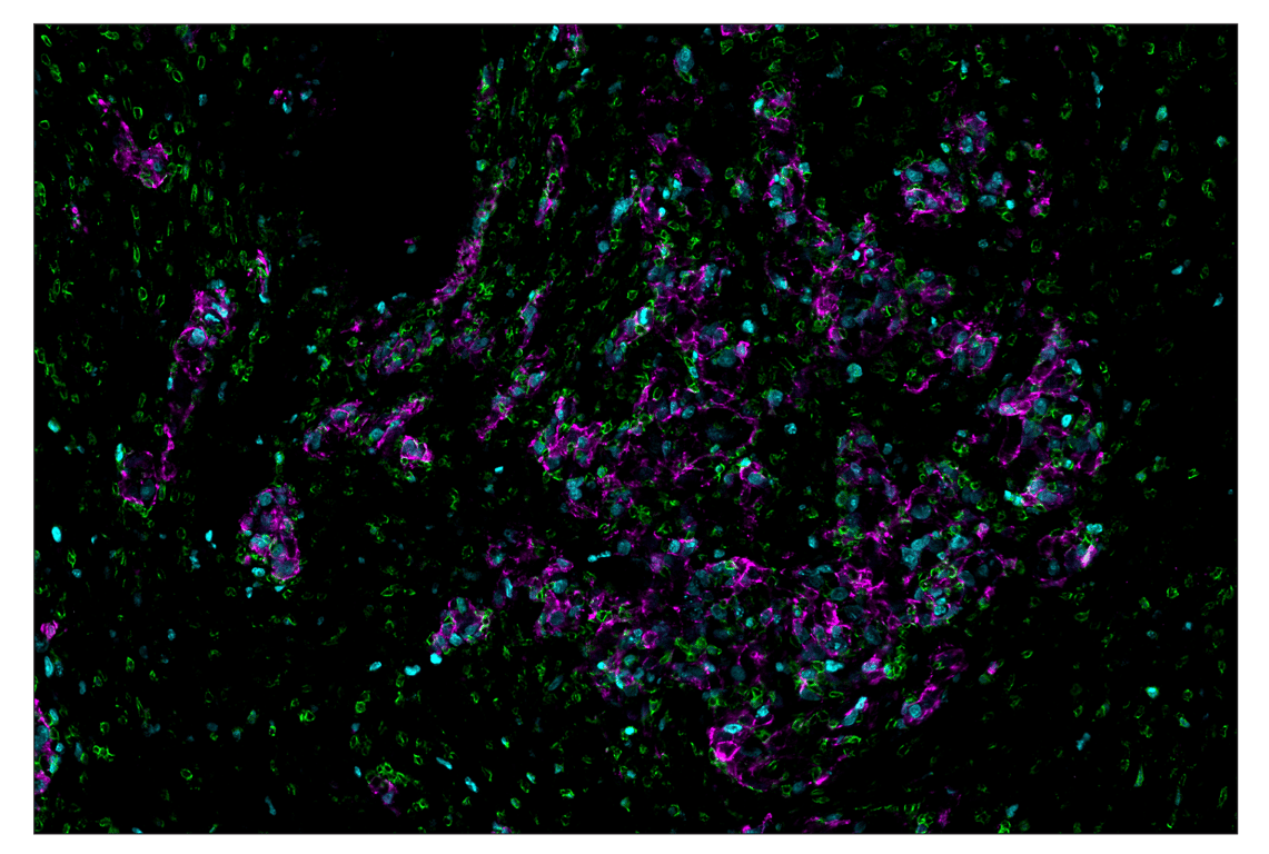 Immunohistochemistry Image 1: Cleaved Caspase-3 (Asp175) (D3E9) & CO-0118-594 SignalStar<sup>™</sup> Oligo-Antibody Pair
