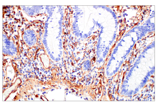 Immunohistochemistry Image 10: Nestin (E4O9E) XP<sup>®</sup> Rabbit mAb