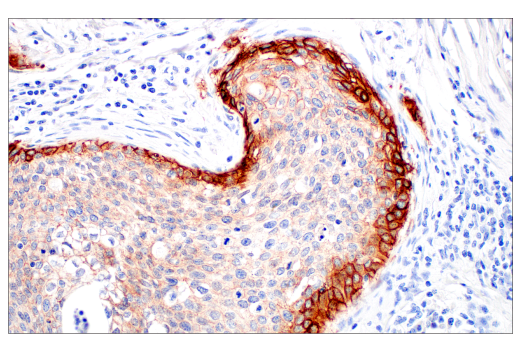 Immunohistochemistry Image 4: Integrin beta6 (E4M9P) Rabbit Monoclonal Antibody (BSA and Azide Free)