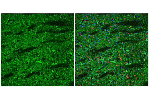 Immunofluorescence Image 2: CaMKII-gamma (E4C3O) Rabbit Monoclonal Antibody