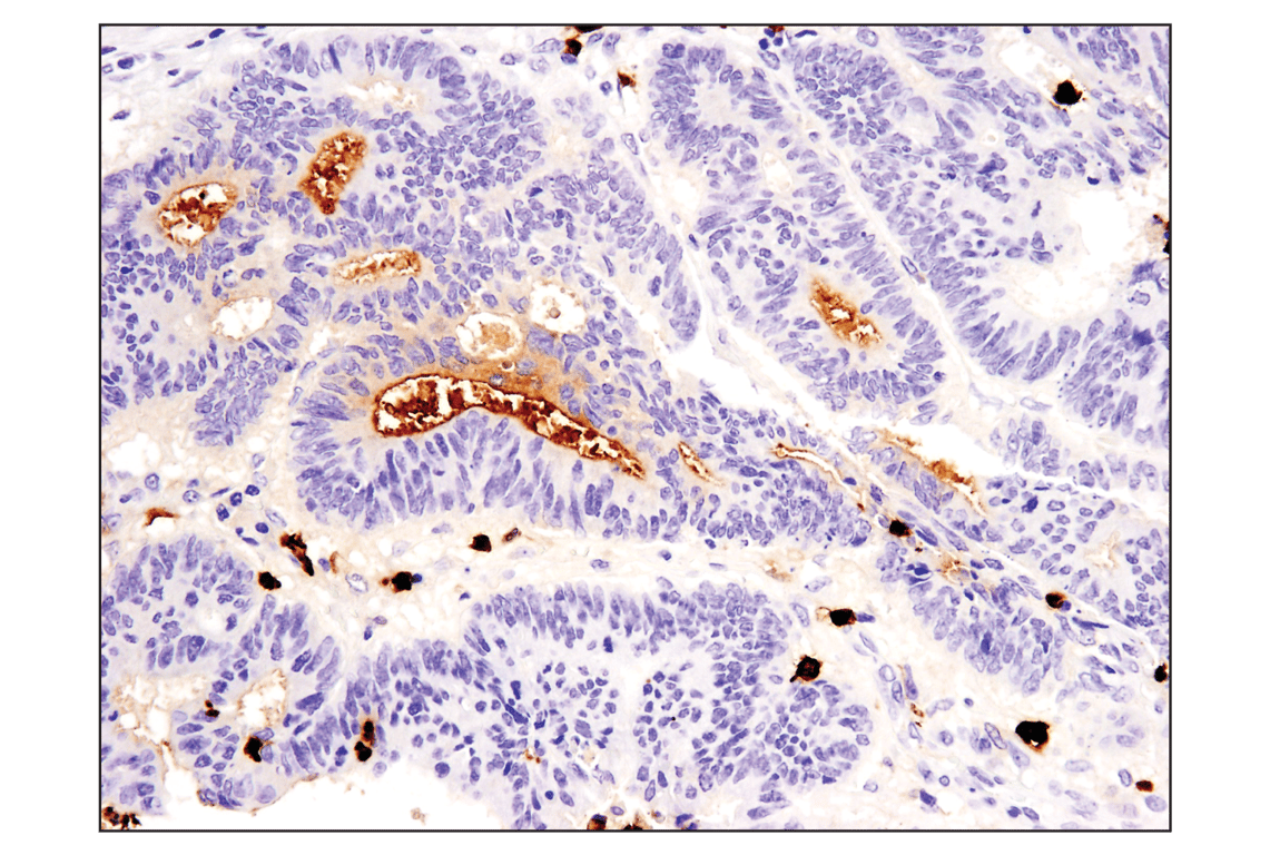 Immunohistochemistry Image 1: S100A9 (D5O6O) Rabbit Monoclonal Antibody (BSA and Azide Free)