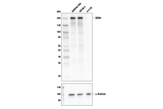 Western Blotting Image 2: XRN1 Antibody