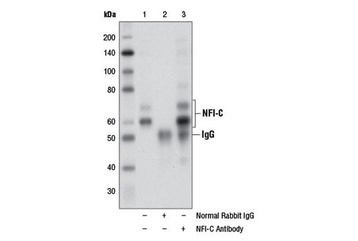 Immunoprecipitation Image 1: NFI-C Antibody
