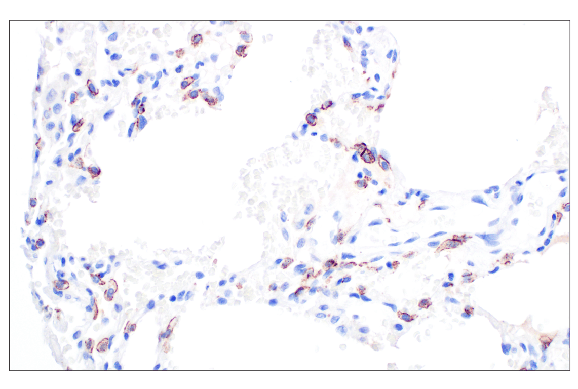 Immunohistochemistry Image 7: CD44 v5 (C44Mab-3) Mouse Monoclonal Antibody