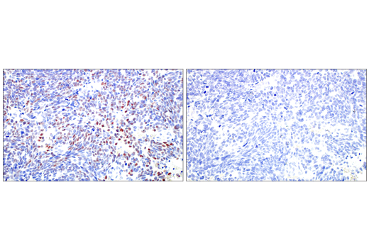 Immunohistochemistry Image 5: ASCL1 (E5S4Q) XP<sup>®</sup> Rabbit mAb