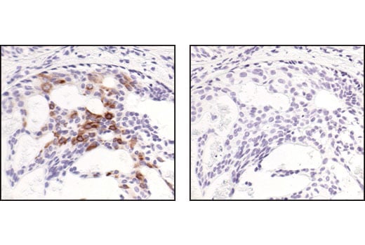 Immunohistochemistry Image 4: Phospho-IKK alpha/beta (Ser176/180) (16A6) Rabbit Monoclonal Antibody (BSA and Azide Free)