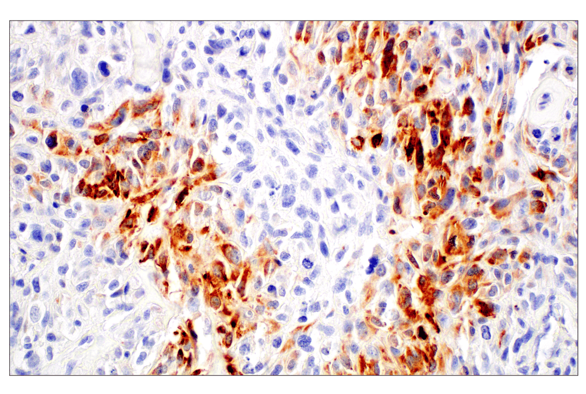 Immunohistochemistry Image 1: Osteocalcin (E8B9X) Rabbit Monoclonal Antibody