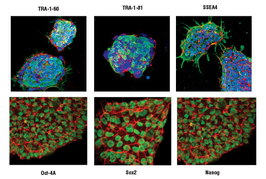 undefined Image 3: StemLight<sup>™</sup> Pluripotency IF Antibody Sampler Kit