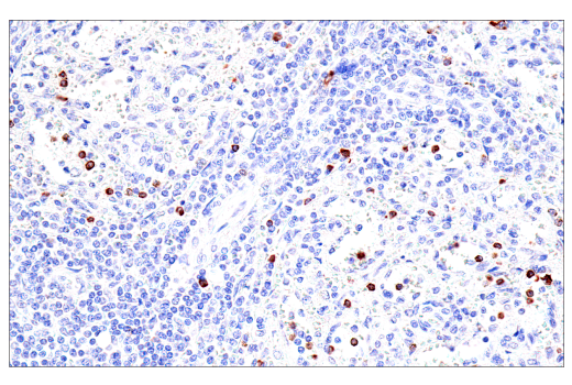 Immunohistochemistry Image 6: GNLY (E2T3D) Rabbit Monoclonal Antibody