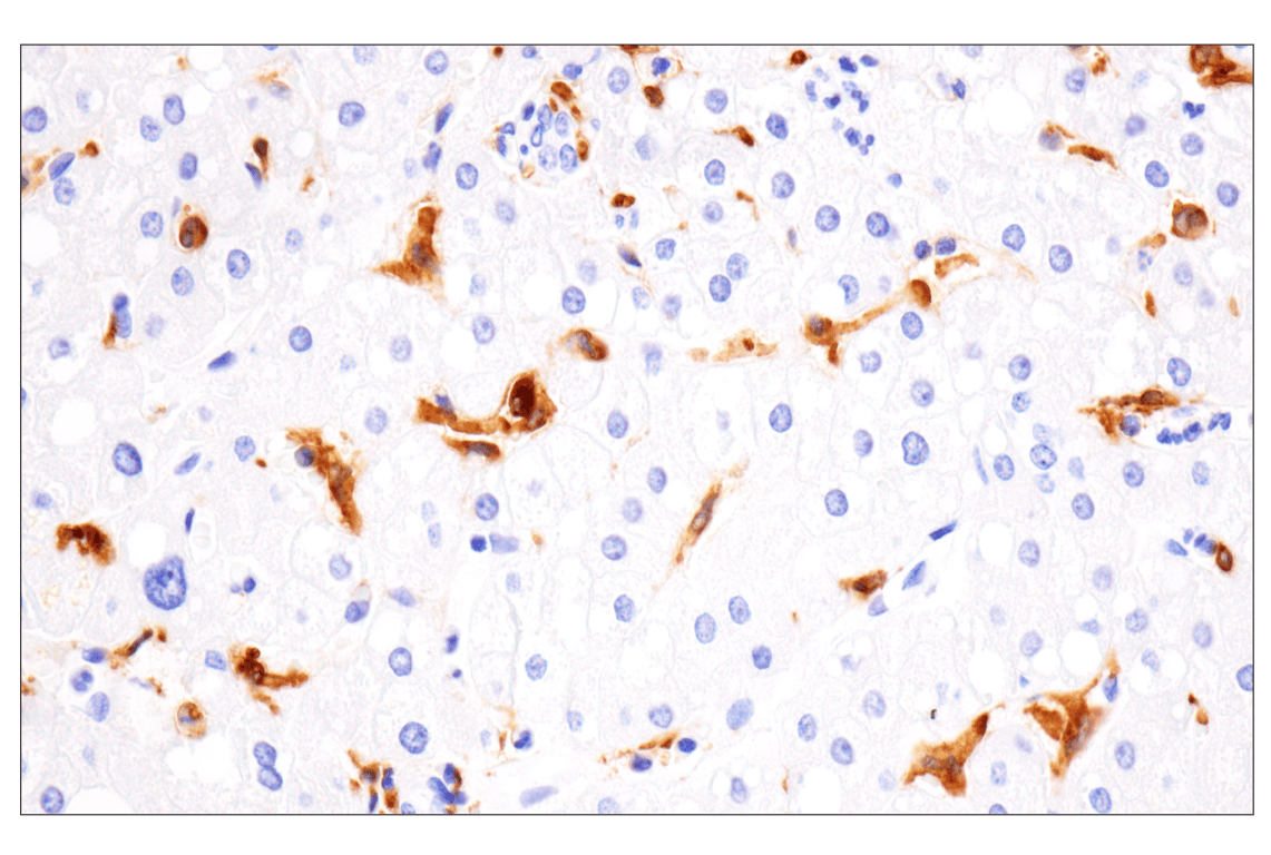 Immunohistochemistry Image 6: HLA-DRA (E9R2Q) Rabbit Monoclonal Antibody (BSA and Azide Free)